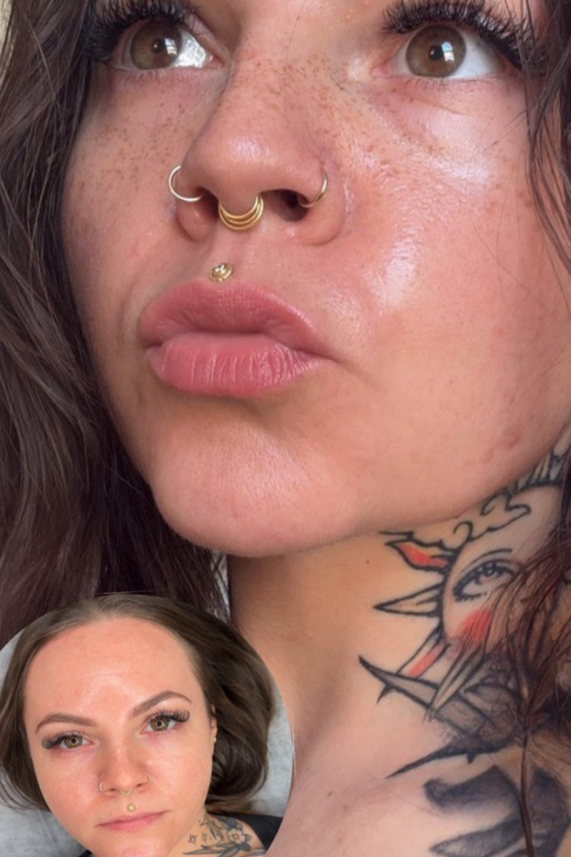 34