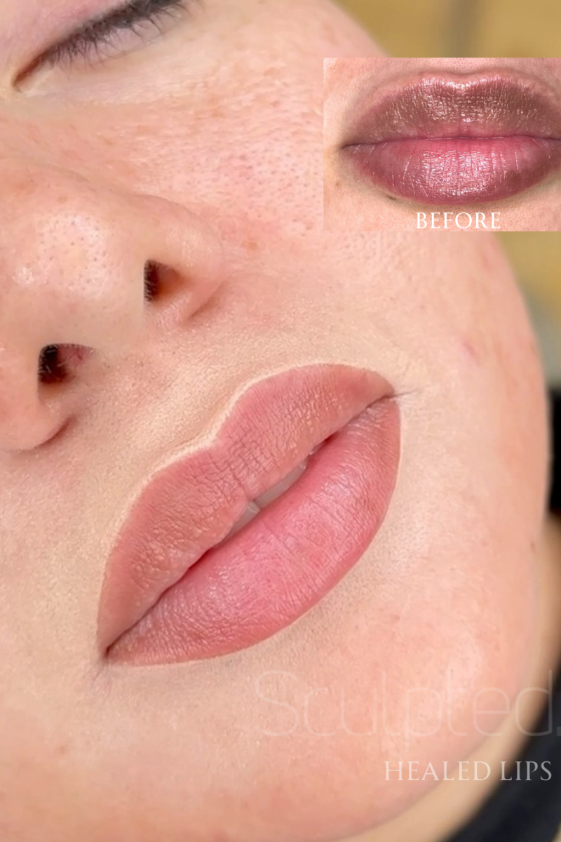 59